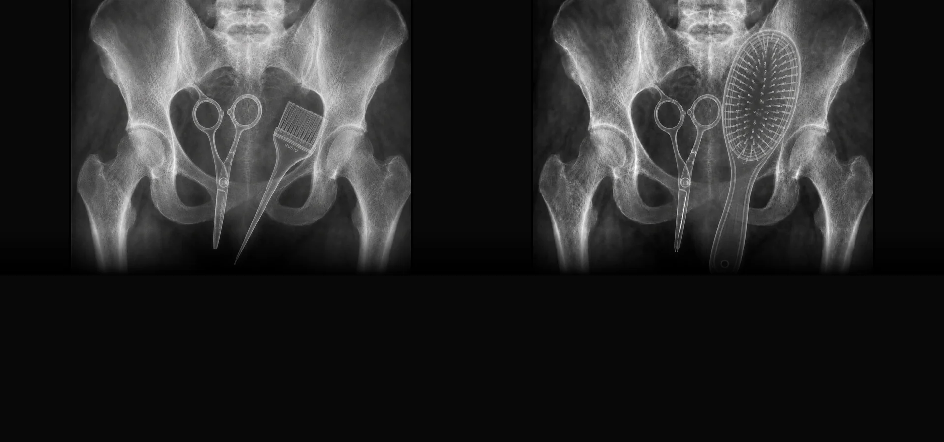 X-rays of hairdressing tools: scissors with a tint brush, and scissors with a paddle brush