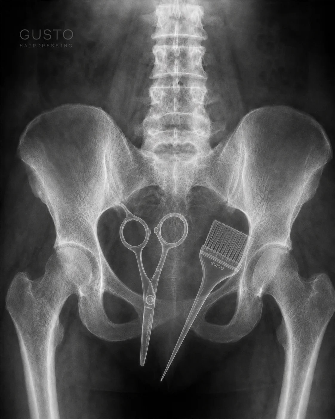 X-ray of a pelvis with hairdressing scissors and a Gusto tint brush inside